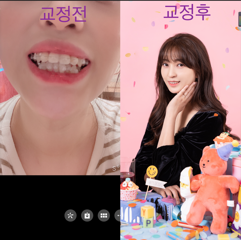 치료사례